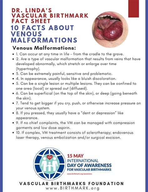 Venous Malformation - Vascular Birthmarks Foundation