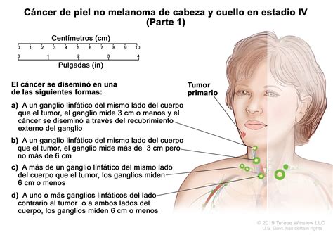 Sintomas Del Cancer De Piel