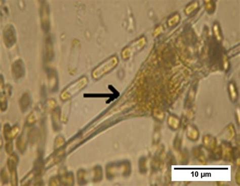 Ceratium sp. Ceratium sp. is contains lots of carotenoid pigments, so ...