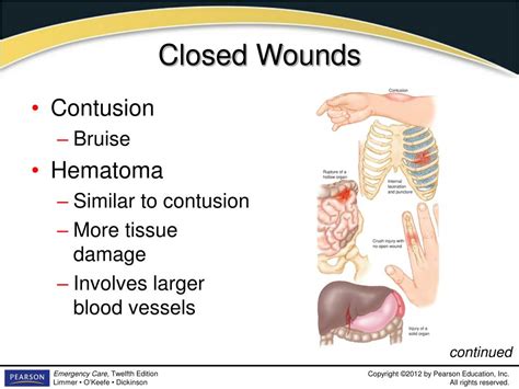 PPT - Introduction to Emergency Medical Care 1 PowerPoint Presentation - ID:5795228