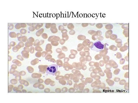 Normal Neutrophil and Monocyte in a smear | Medical Laboratories