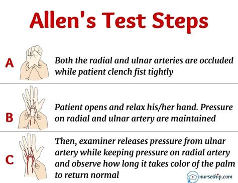 Allen Test | How to Perform| Interpretation of Results – NurseShip