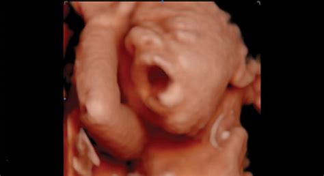 Ultrasound Packages | Cedar Park Ultrasound | 3D/4D HD Elective ...