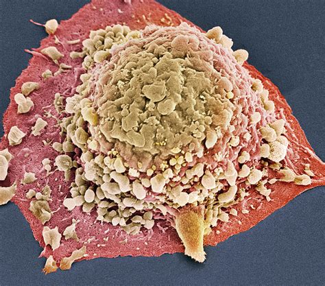Colon Cancer Cell, Sem Photograph by Steve Gschmeissner