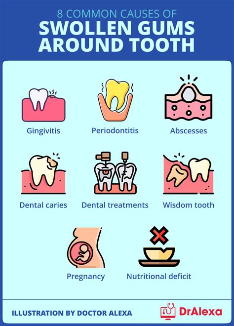 Swollen Gums Around Tooth - Causes and Treatment Options (2023)