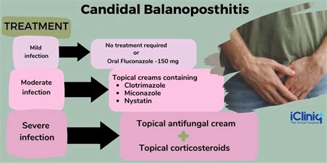 Balanitis Treatment Home Remedy