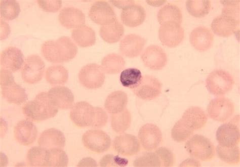Free picture: plasmodium malariae, schizont, chromatin, masses, well, growing, trophozoites ...