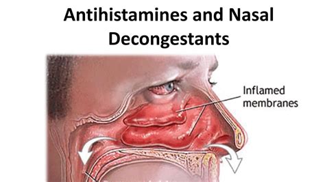 Antihistamine & Nasal decongestant drugs - YouTube