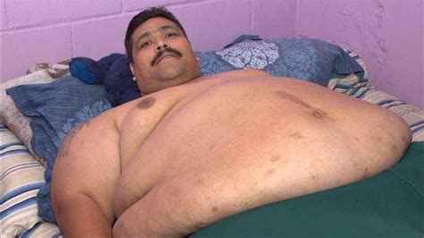 At nearly 1000 lbs., world's heaviest man to undergo weight-loss ...