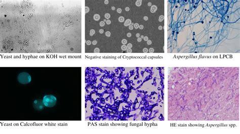 Fungal Staining Methods and Uses • Microbe Online