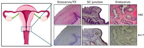 Endocervix Histology