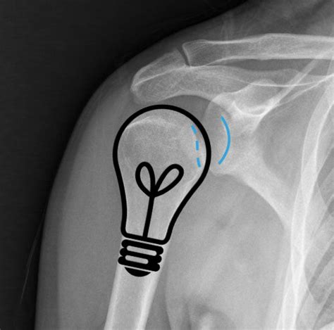 Ortho Case: Shoulder Injury — Kwak Talk