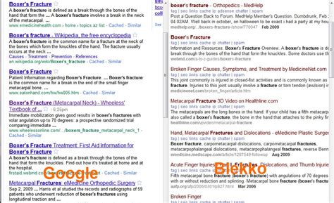 Blekko launches the biased search engine - CNET