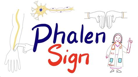 Phalen Sign (Phalen Test or Maneuver) Carpal Tunnel Syndrome | Clinical ...