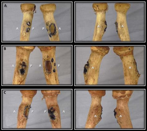 Figure 5 from The Importance of Preserving the Radial Tuberosity During ...