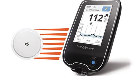 Abbott’s Continuous Glucose Monitoring System to Replace Finger Sticks ...