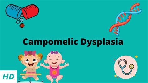 Campomelic Dysplasia, Causes, Signs and Symptoms, Diagnosis and ...