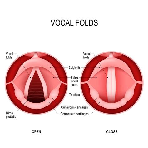 Vocal Cord Paresis (Paralysis): Symptoms, Causes, and Treatment Options