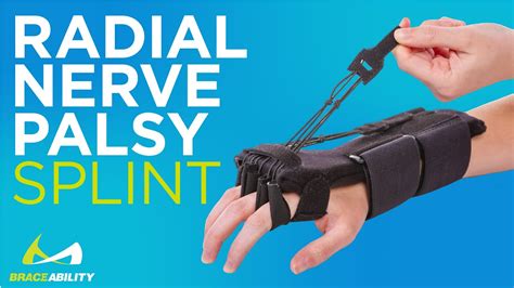 Radial Nerve Palsy Splint | Dynamic Wrist Drop & Finger Extension Brace - YouTube