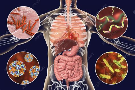 Bacteria that cause human infections, illustration - Stock Image - F023/9654 - Science Photo Library
