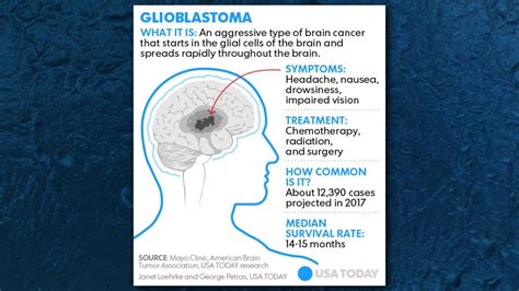 John McCain's cancer: What is glioblastoma? | wgrz.com