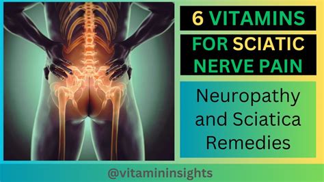 Sciatic Nerve Pain Relief: The Top 6 Essential Vitamins You Need - YouTube