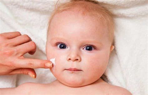 Skin Irritation in Babies: What to Do - You are Mom