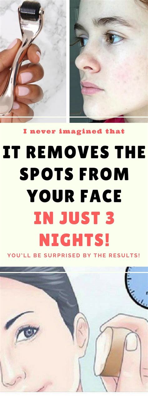 It Will Remove The Spots From Your Face In Just 3 Nights! | How to ...