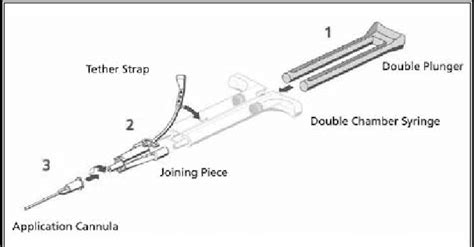 Fibrin glue application device. | Download Scientific Diagram