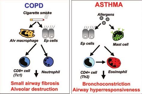 COPD VS. Asthma Chronic obstructive pulmonary disease (โรคปอดอุดกั้น ...