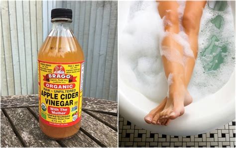 6 Reasons To Add Apple Cider Vinegar To Your Next Bath