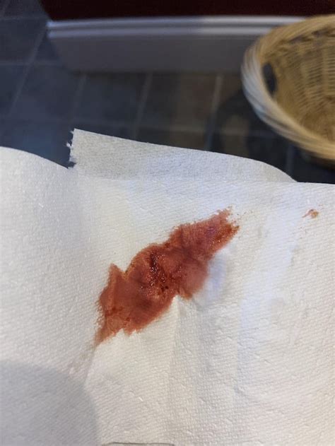 Pooping issue, was constipated, can poop now but feels like something ...