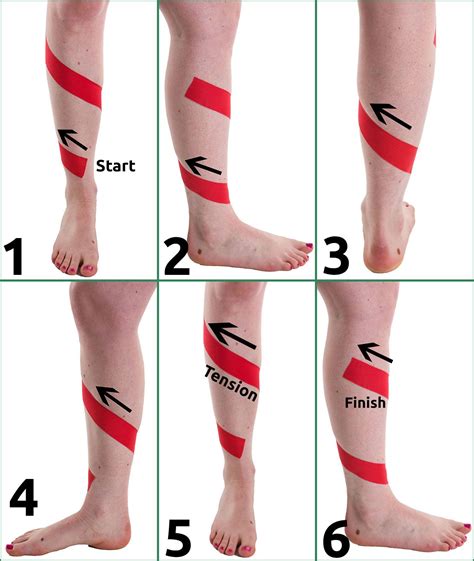 #Shinsplints | Shin splints taping, Shin splints, Kinesiology taping