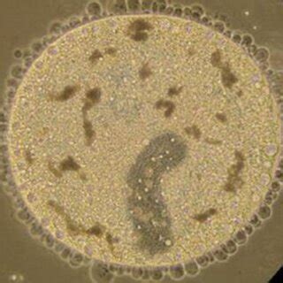 Life cycle of the endoparasite Ichthyophthirius multifiliis | Download Scientific Diagram