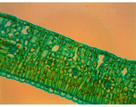 Leaf Cross Section Microscope Quiz