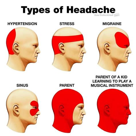 Brain Tumor Headache Pattern | Chumado