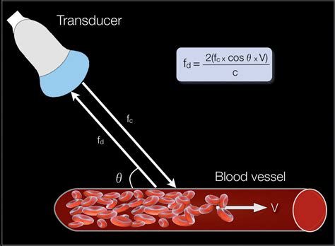 Pulsed Doppler in Fetal Echocardiography | Obgyn Key