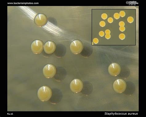 Staphylococcus aureus- An Overview - Microbe Notes (2022)