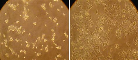 Propagation of HepG2 cell line on RPMI 10% FBS medium. (a) 30% ...