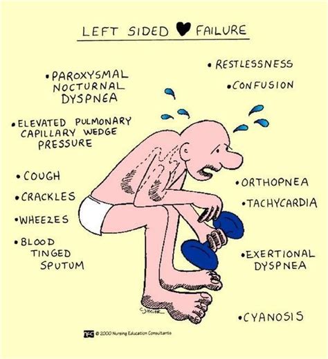 Left sided Heart Failure | Because I'm a Nursing student... | Pinterest