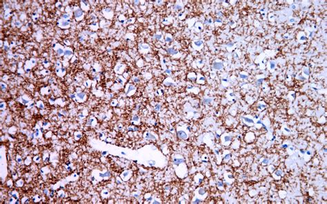 Myelin Basic Protein Antibody - Rabbit Monoclonal Antibody (Mab) IHC - Buy Now! |Abcepta