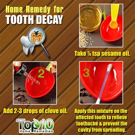 Home Remedies for Tooth Decay and Cavities | Top 10 Home Remedies