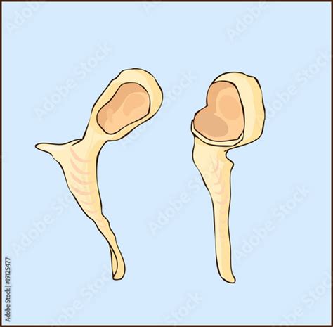 Malleus ear bone medical illustration, skeletal Anatomy, ear bo - Buy ...