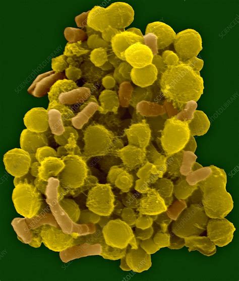 Human tongue oral bacteria, SEM - Stock Image - C032/2355 - Science Photo Library