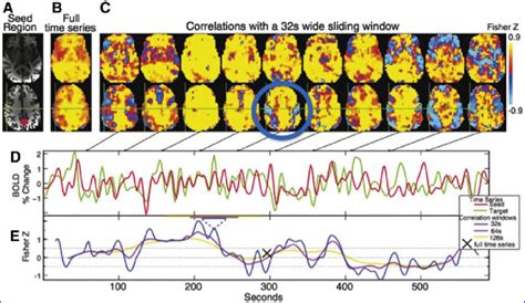 Correlations of anterior cingulate with the brain. (A) Red highlight ...