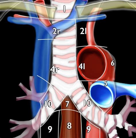 The Radiology Assistant : Mediastinal Lymph Node Map (2023)