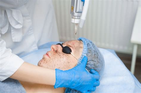 Laser dermatology Images - Search Images on Everypixel