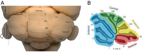 Anatomia | Free Full-Text | Lobe X of the Cerebellum: A Natural Neuro ...