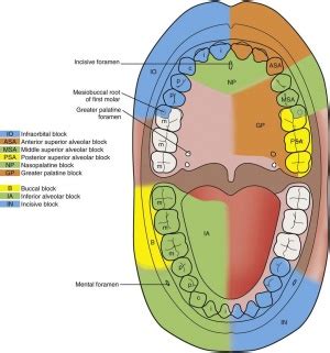 Inferior Alveolar Nerve Block Landmarks