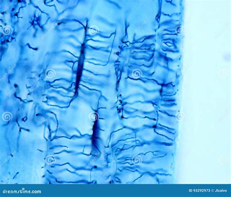 Osteocytes. Schmorlâ€™s Technique Stock Image - Image of microscopy, bone: 93292973